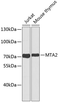 Western blot - MTA2 Polyclonal Antibody 