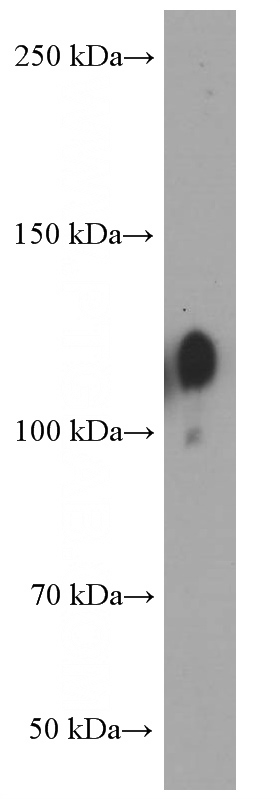 HT-1080 cells were subjected to SDS PAGE followed by western blot with Catalog No:107352(Integrin beta-1 Antibody) at dilution of 1:8000
