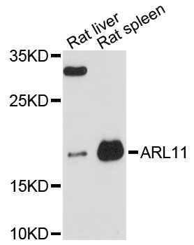 Western blot - ARL11 Polyclonal Antibody 