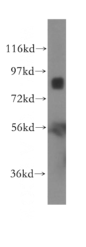 K-562 cells were subjected to SDS PAGE followed by western blot with Catalog No:111867(ITGB7 antibody) at dilution of 1:1000