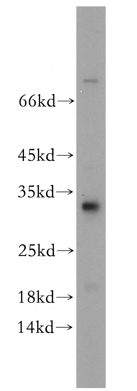 mouse brain tissue were subjected to SDS PAGE followed by western blot with Catalog No:109948(DNAJC27 antibody) at dilution of 1:1500