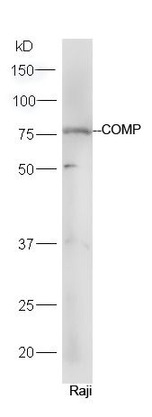 Fig1: Protein: Raji lysate;; Primary: rabbit Anti-COMP at 1:300;; Secondary: HRP conjugated Goat-Anti-rabbit IgG(bs-0295G-HRP) at 1: 5000;; Predicted band size: 83 kD; Observed band size: 77 kD