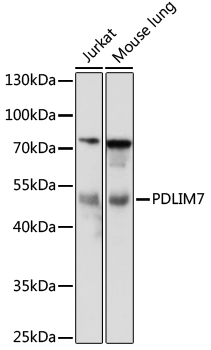 Western blot - PDLIM7 Polyclonal Antibody 