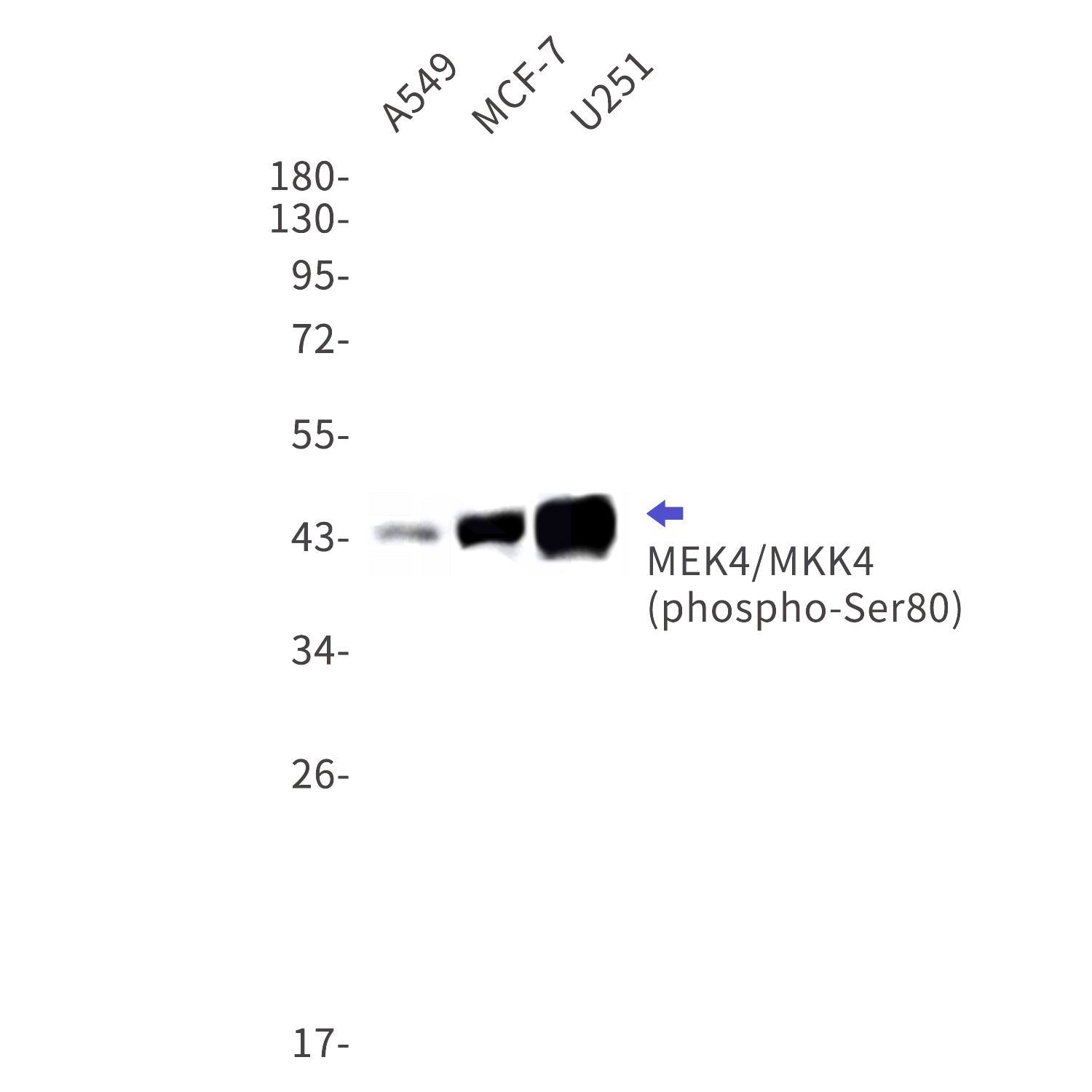 Western blot detection of phospho-MEK4/MKK4 (Ser80) in A549,MCF-7,U251 cell lysates using phospho-MEK4/MKK4 (Ser80) Rabbit mAb(1:1000 diluted).Predicted band size:44kDa.Observed band size:44kDa.