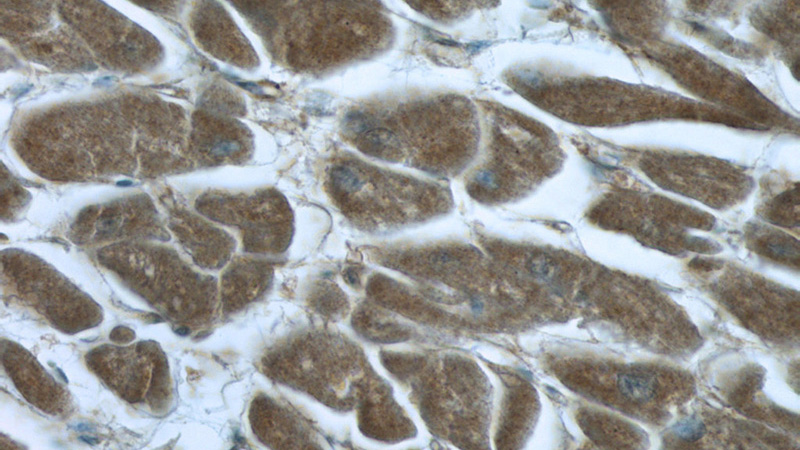 Immunohistochemistry of paraffin-embedded human heart tissue slide using Catalog No:117117(BEND4 Antibody) at dilution of 1:50 (under 40x lens)