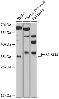 Western blot - RNF212 Polyclonal Antibody 