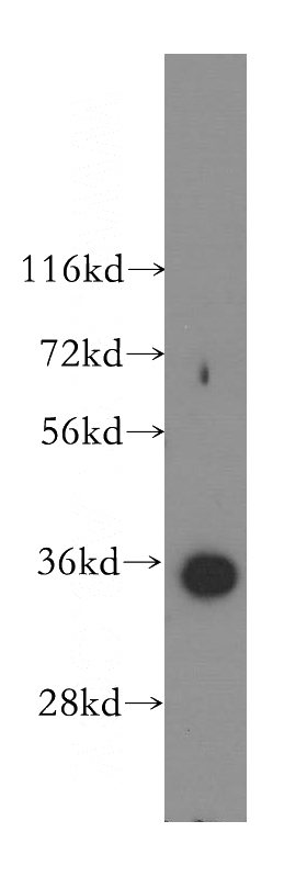 PC-3 cells were subjected to SDS PAGE followed by western blot with Catalog No:116240(TOMM34 antibody) at dilution of 1:400
