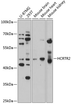 Western blot - HCRTR2 Polyclonal Antibody 
