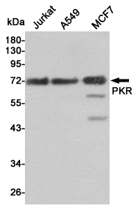 Western blot detection of PKR in Jurkat,A549 and MCF7 cell lysates using PKR mouse mAb (1:1000 diluted).Predicted band size:62KDa.Observed band size:74KDa.