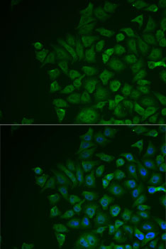 Immunofluorescence - LRAT Polyclonal Antibody 