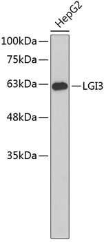 Western blot - LGI3 Polyclonal Antibody 