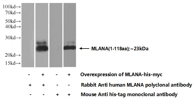 Transfected HEK-293 cells were subjected to SDS PAGE followed by western blot with Catalog No:112672(MLANA Antibody) at dilution of 1:700
