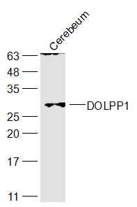 Fig1: Sample:; Cerebrum (Mouse) Lysate at 40 ug; Primary: Anti-DOLPP1 at 1/300 dilution; Secondary: IRDye800CW Goat Anti-Rabbit IgG at 1/20000 dilution; Predicted band size: 27 kD; Observed band size: 27 kD