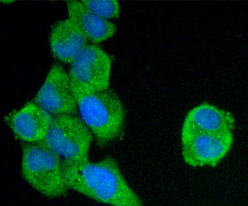 Fig2: ICC staining C19orf35 in Hela cells (green). The nuclear counter stain is DAPI (blue). Cells were fixed in paraformaldehyde, permeabilised with 0.25% Triton X100/PBS.