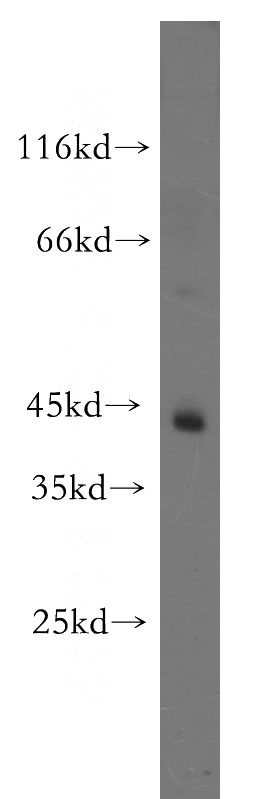 SH-SY5Y cells were subjected to SDS PAGE followed by western blot with Catalog No:116480(TTL antibody) at dilution of 1:1000