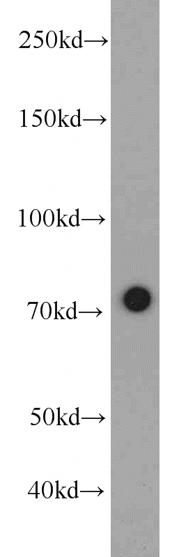 HeLa cells were subjected to SDS PAGE followed by western blot with Catalog No:107496(RACGAP1 antibody) at dilution of 1:1000