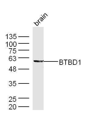 Fig1: Sample: Brain (Mouse) Lysate at 40 ug; Primary: Anti-BTBD1 at 1/300 dilution; Secondary: IRDye800CW Goat Anti-Rabbit IgG at 1/20000 dilution; Predicted band size: 53 kD; Observed band size: 53 kD