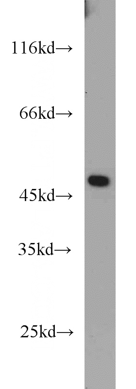 mouse brain tissue were subjected to SDS PAGE followed by western blot with Catalog No:116284(TMX4 antibody) at dilution of 1:1000