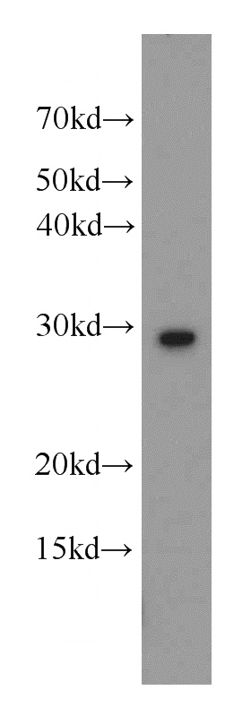 K-562 cells were subjected to SDS PAGE followed by western blot with Catalog No:116578(UROS antibody) at dilution of 1:600