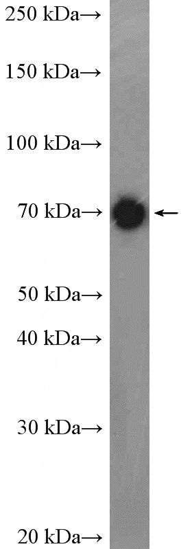 mouse brain tissue were subjected to SDS PAGE followed by western blot with Catalog No:110024(DNM1L,DLP1 Antibody) at dilution of 1:600
