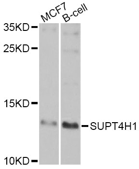 Western blot - SUPT4H1 Polyclonal Antibody 