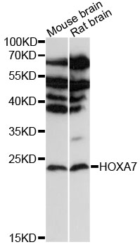 Western blot - HOXA7 Polyclonal Antibody 