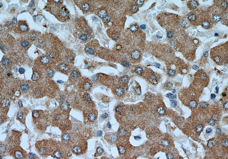 Immunohistochemical of paraffin-embedded human liver using Catalog No:107641(TKT antibody) at dilution of 1:50 (under 40x lens)