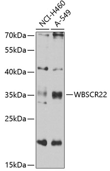 Western blot - WBSCR22 Polyclonal Antibody 