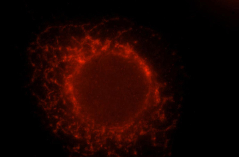Immunofluorescent analysis of MCF-7 cells, using RPS6KA5 antibody Catalog No:112871 at 1:25 dilution and Rhodamine-labeled goat anti-rabbit IgG (red).