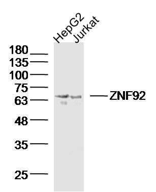 Fig1: Sample:; HepG2 Cell (Human) Lysate at 40 ug; Jurkat Cell (Human) Lysate at 40 ug; Primary: Anti-ZNF92 at 1/300 dilution; Secondary: IRDye800CW Goat Anti-Rabbit IgG at 1/20000 dilution; Predicted band size: 68 kD; Observed band size: 68 kD