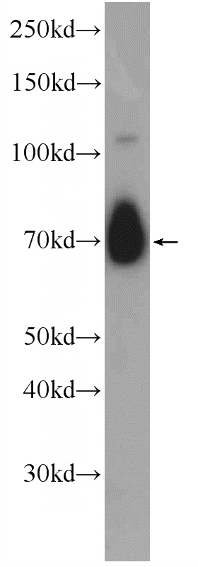 mouse brain tissue were subjected to SDS PAGE followed by western blot with Catalog No:108100(ANO10 Antibody) at dilution of 1:1000