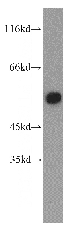 mouse brain tissue were subjected to SDS PAGE followed by western blot with Catalog No:109878(DBNL antibody) at dilution of 1:1000