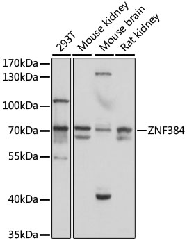 Western blot - ZNF384 Polyclonal Antibody 