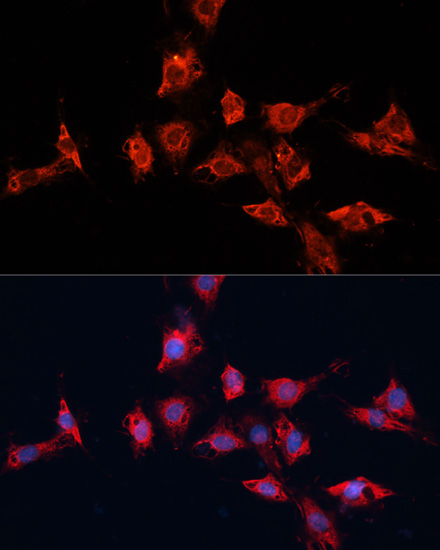 Immunofluorescence - ADAM11 Polyclonal Antibody 