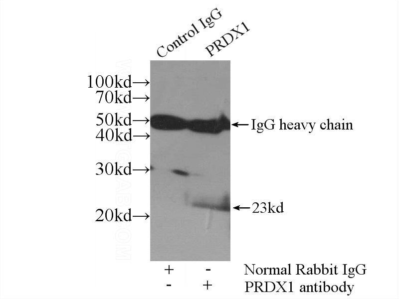 IP Result of anti-PRDX1 (IP:Catalog No:114175, 3ug; Detection:Catalog No:114175 1:1000) with HeLa cells lysate 2400ug.
