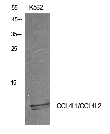 Fig1:; Western Blot analysis of K562 cells using MIP-1b Polyclonal Antibody. Antibody was diluted at 1:500. Secondary antibody（catalog#：HA1001) was diluted at 1:20000