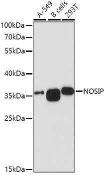 Western blot - NOSIP Polyclonal Antibody 