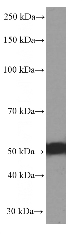 COLO 320 cells were subjected to SDS PAGE followed by western blot with Catalog No:107446(P53 Antibody) at dilution of 1:2000