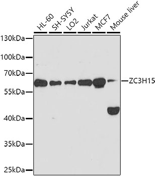 Western blot - ZC3H15 Polyclonal Antibody 