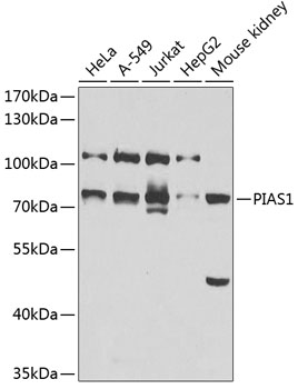 Western blot - PIAS1 Polyclonal Antibody 