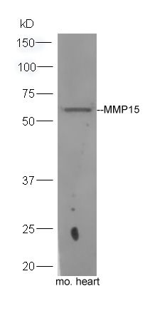 Fig2: Sample: Heart(Mouse) lysate at 30ug;; Primary: Anti- MMP15 at 1:300 dilution;; Secondary: HRP conjugated Goat-Anti-rabbit IgG(bs-0295G-HRP) at 1: 5000 dilution;; Predicted band size:61 kD; Observed band size:61 kD