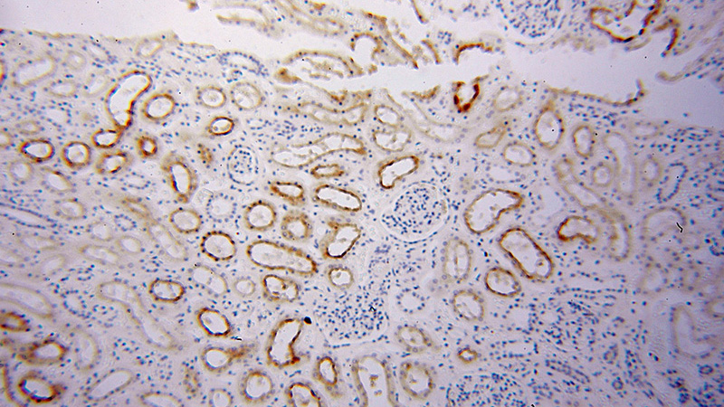 Immunohistochemical of paraffin-embedded human kidney using Catalog No:113176(NHE8 antibody) at dilution of 1:100 (under 10x lens)