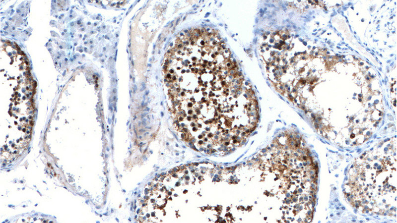 Immunohistochemistry of paraffin-embedded human testis tissue slide using Catalog No:108756(CABYR Antibody) at dilution of 1:200 (under 10x lens)