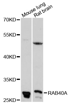 Western blot - RAB40A Polyclonal Antibody 
