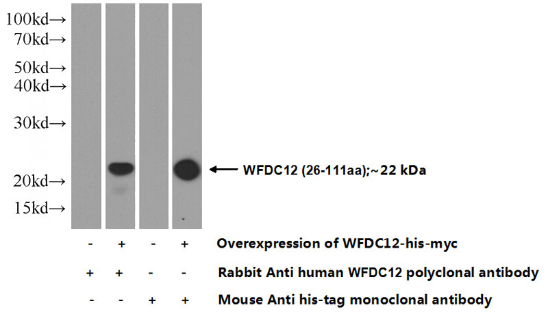 Transfected HEK-293 cells were subjected to SDS PAGE followed by western blot with Catalog No:116822(WFDC12 Antibody) at dilution of 1:500