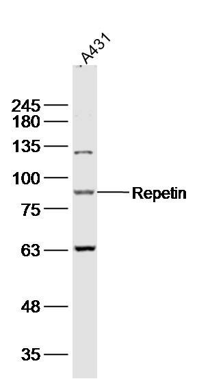 Fig1: Sample:; A431(human) cell Lysate at 40 ug; Primary: Anti- repetin at 1/300 dilution; Secondary: IRDye800CW Goat Anti-Rabbit IgG at 1/20000 dilution; Predicted band size: 91kD; Observed band size: 91 kD