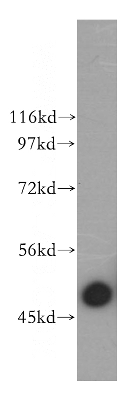 mouse spleen tissue were subjected to SDS PAGE followed by western blot with Catalog No:108162(ACTR3 antibody) at dilution of 1:1000