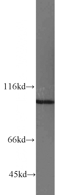 HeLa cells were subjected to SDS PAGE followed by western blot with Catalog No:112981(MYO19 antibody) at dilution of 1:1000