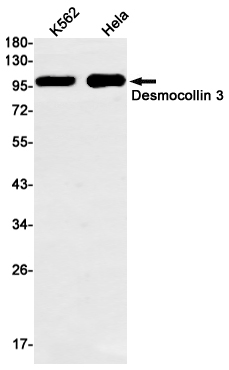 Western blot detection of Desmocollin 3 in K562,Hela cell lysates using Desmocollin 3 Rabbit mAb(1:1000 diluted).Predicted band size:100kDa.Observed band size:100kDa.