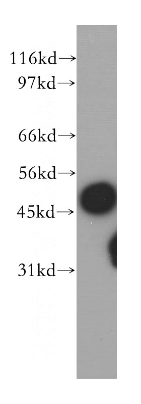 PC-3 cells were subjected to SDS PAGE followed by western blot with Catalog No:115818(SUCLA2 antibody) at dilution of 1:500